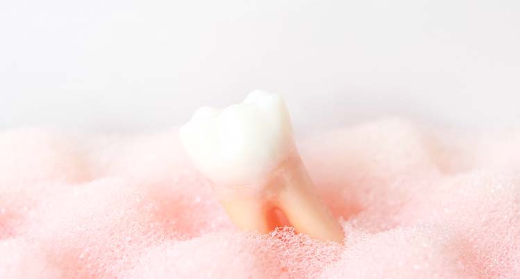 ピンクのスポンジに歯が生えているイメージ