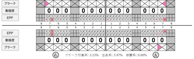 症例