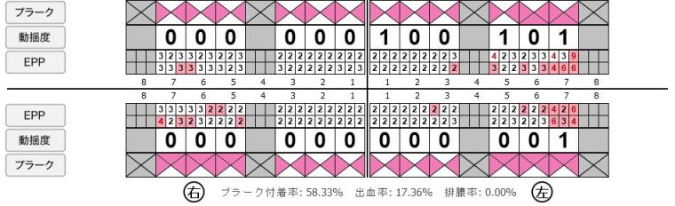 症例
