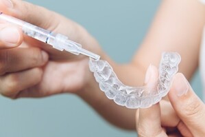 ホームホワイトニングのトレーにホワイトニングジェルを塗布している様子