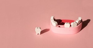 歯の模型から1本歯が抜けている状態の写真