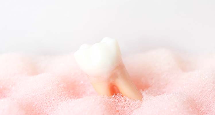 抜歯後の合併症